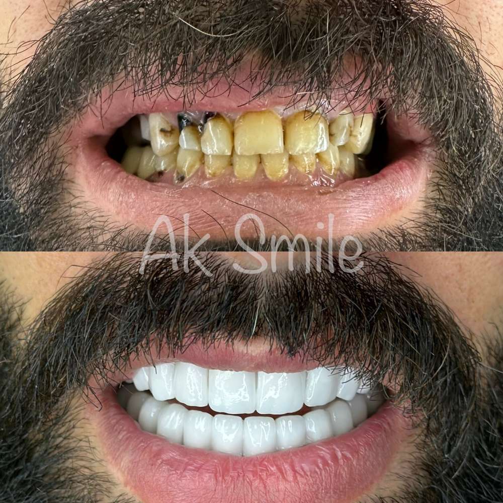 Ak smile diş polikliniği