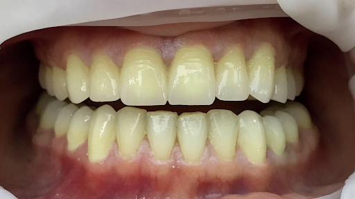 DENT18 Diş Kliniği Çankırı Diş Hekimi Sebahattin KARAKAYA Diş Hekimi Hakan DEMİROK