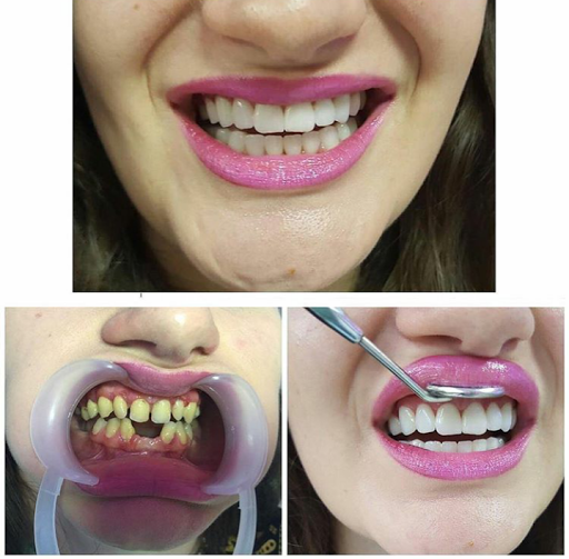 dental klinik osmaniye