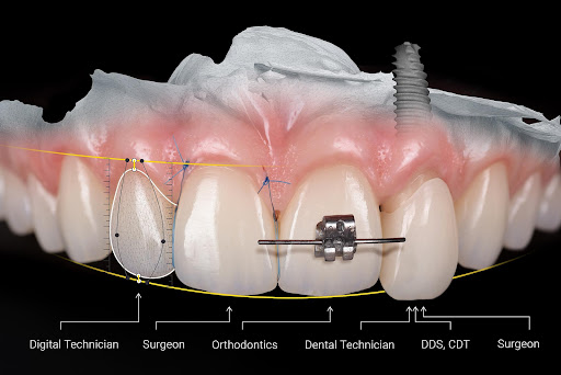 DentMaks İstanbul “Kahraman Ortodonti ve Estetik Diş Kliniği” Ortodontist Yrd.Doç.Dr. Fatih KAHRAMAN, Dt. Ayşe Nur KAHRAMAN