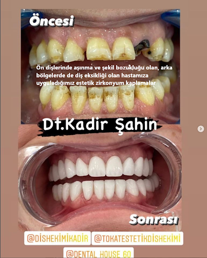 Diş Hekimi Kadir Şahin /TOKAT