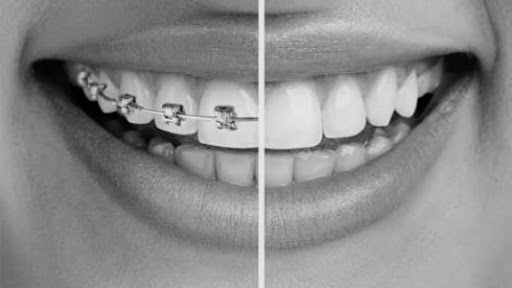 Ortodonti Uzmanı Yrd.Doç.Dr.Feyza Holoğlu