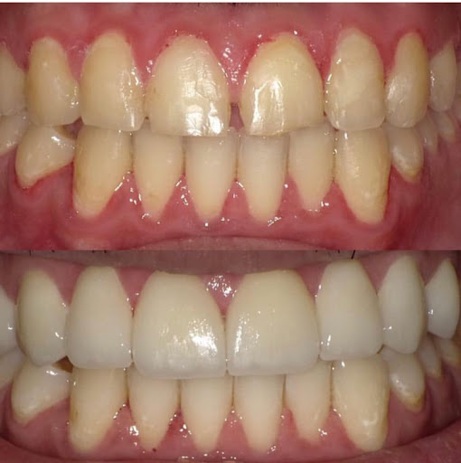 Özel Bayrampaşa Dentica Ağız Ve Diş Sağlığı Polikliniği