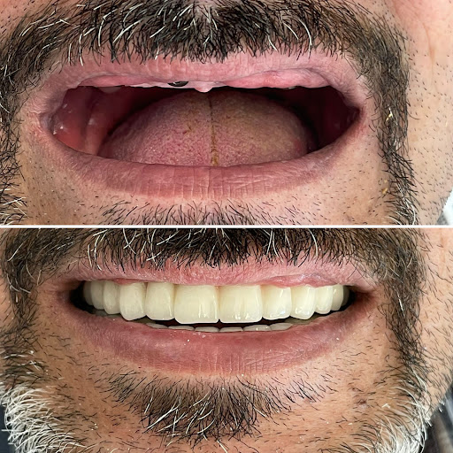 ÖZEL DENT DENT ORAL AND DENTAL HEALTH CENTER