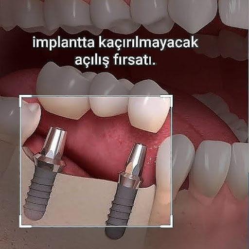 Özel Medidenta Ayrancılar Ağız ve Diş sağlığı Polikliniği